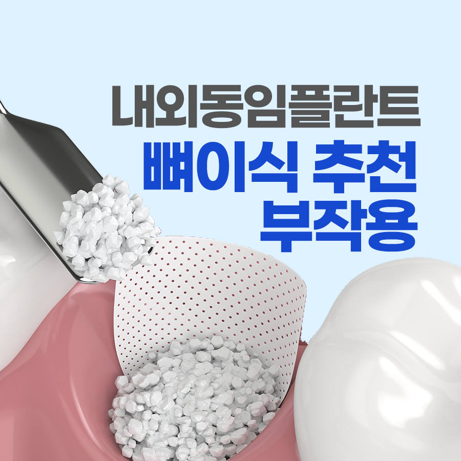 김해 내외동임플란트 뼈이식 추천, 부작용