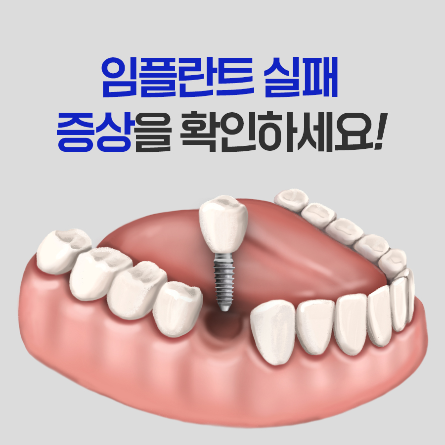 김해 임플란트 실패 신호는 어떤 증상들이 있을까